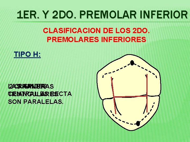 1 ER. Y 2 DO. PREMOLAR INFERIOR CLASIFICACION DE LOS 2 DO. PREMOLARES INFERIORES