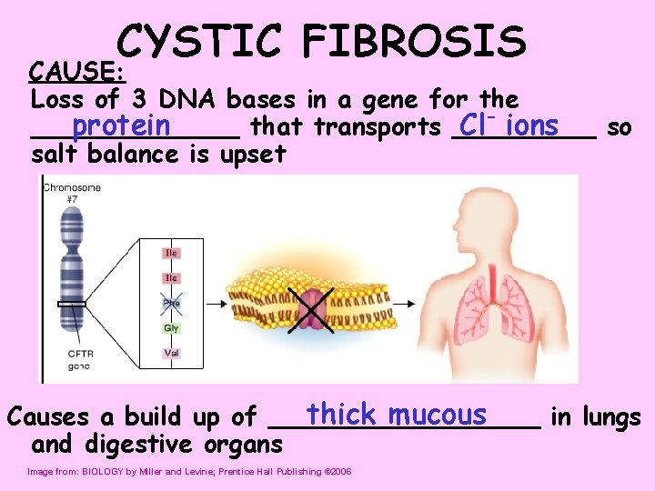 CYSTIC FIBROSIS CAUSE: Loss of 3 DNA bases in a gene for the protein