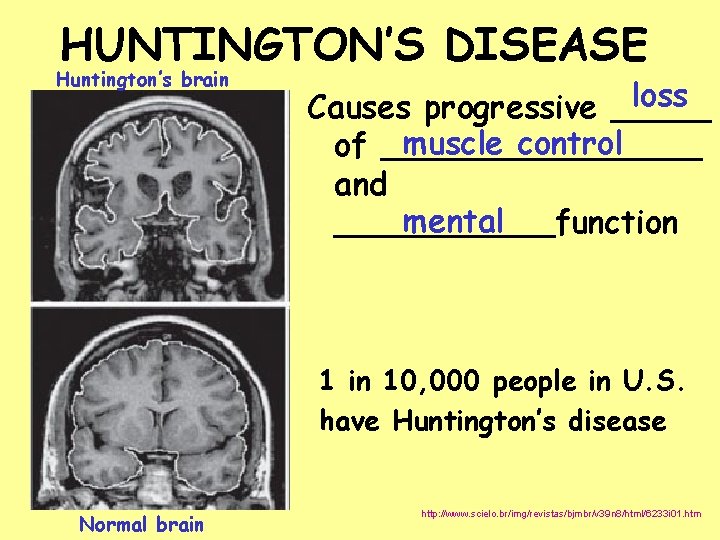 HUNTINGTON’S DISEASE Huntington’s brain loss Causes progressive _____ muscle control of ________ and mental