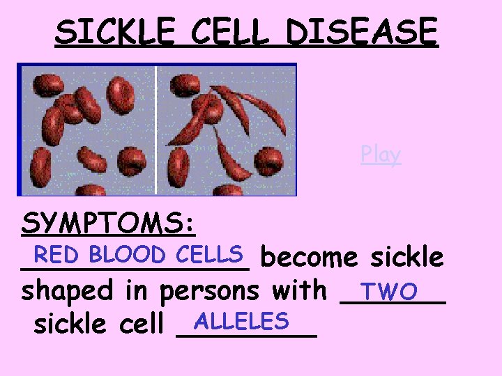 SICKLE CELL DISEASE Play SYMPTOMS: RED BLOOD CELLS become sickle _______ TWO shaped in SICKLE CELL DISEASE Play SYMPTOMS: RED BLOOD CELLS become sickle _______ TWO shaped in