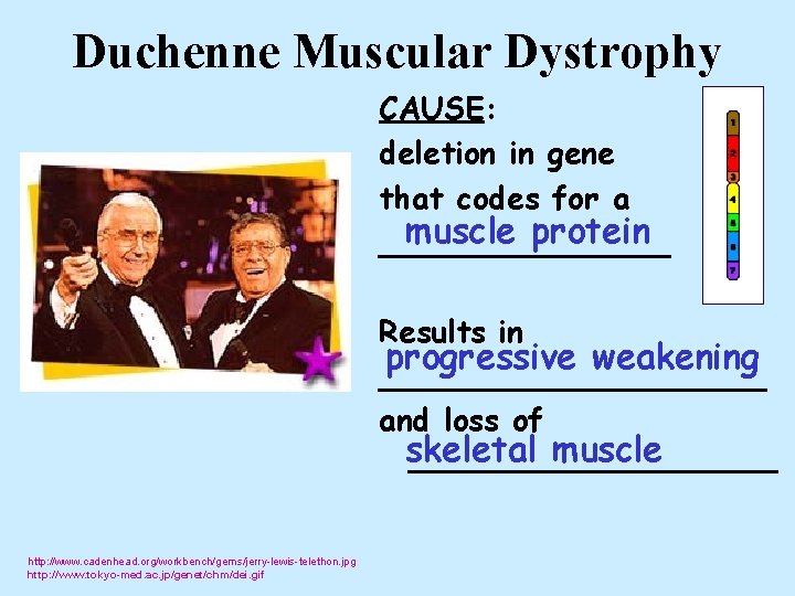 Duchenne Muscular Dystrophy CAUSE: deletion in gene that codes for a muscle protein ________