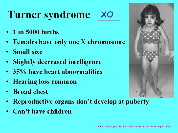 XO Turner syndrome ____ • • • 1 in 5000 births Females have only