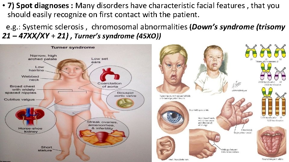  • 7) Spot diagnoses : Many disorders have characteristic facial features , that