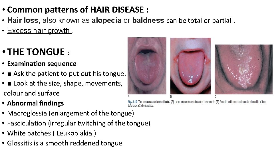  • Common patterns of HAIR DISEASE : • Hair loss, also known as