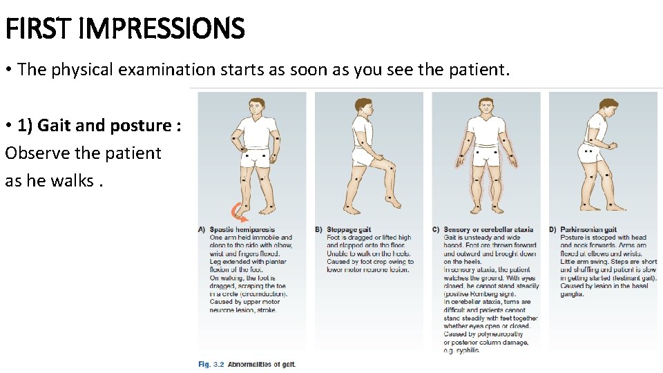 FIRST IMPRESSIONS • The physical examination starts as soon as you see the patient.