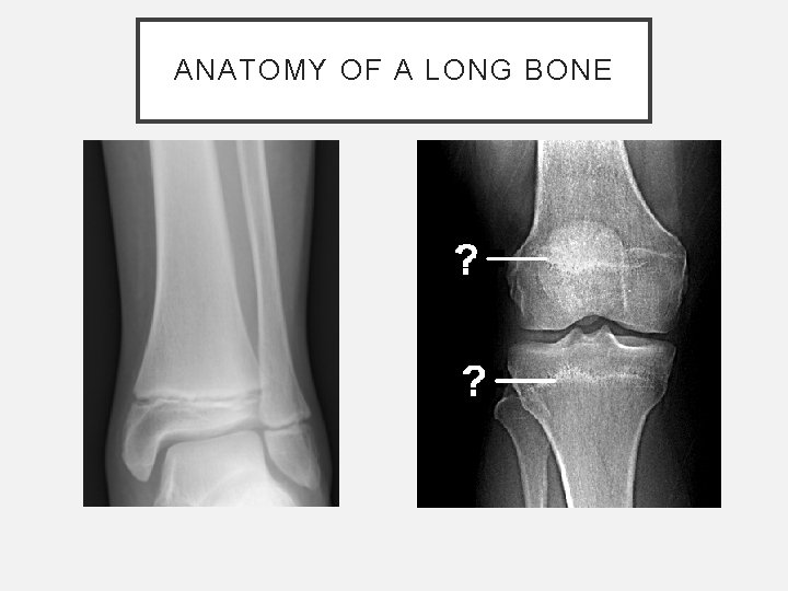ANATOMY OF A LONG BONE ANATOMY OF A LONG BONE