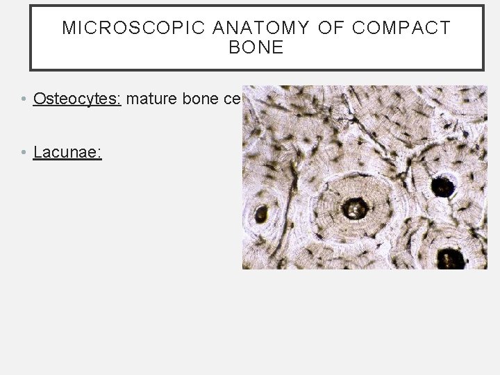 MICROSCOPIC ANATOMY OF COMPACT BONE • Osteocytes: mature bone cells • Lacunae: MICROSCOPIC ANATOMY OF COMPACT BONE • Osteocytes: mature bone cells • Lacunae: