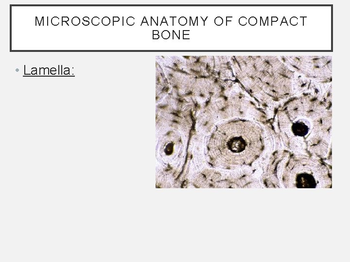 MICROSCOPIC ANATOMY OF COMPACT BONE • Lamella: MICROSCOPIC ANATOMY OF COMPACT BONE • Lamella: