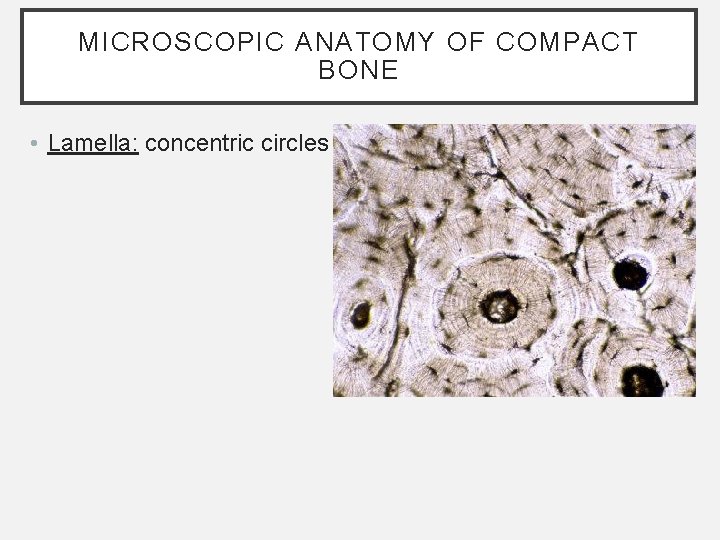 MICROSCOPIC ANATOMY OF COMPACT BONE • Lamella: concentric circles MICROSCOPIC ANATOMY OF COMPACT BONE • Lamella: concentric circles