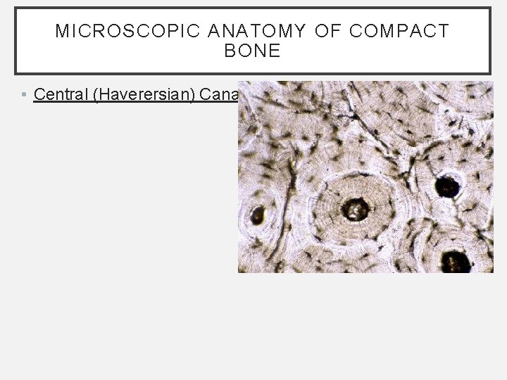 MICROSCOPIC ANATOMY OF COMPACT BONE • Central (Haverersian) Canals: MICROSCOPIC ANATOMY OF COMPACT BONE • Central (Haverersian) Canals: