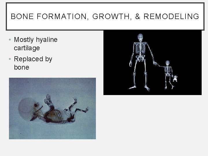 BONE FORMATION, GROWTH, & REMODELING • Mostly hyaline cartilage • Replaced by bone BONE FORMATION, GROWTH, & REMODELING • Mostly hyaline cartilage • Replaced by bone