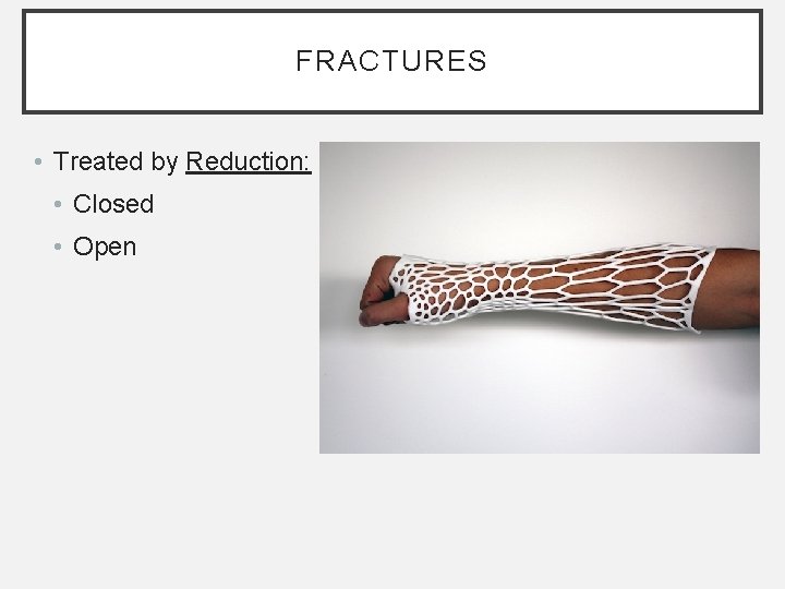 FRACTURES • Treated by Reduction: • Closed • Open FRACTURES • Treated by Reduction: • Closed • Open