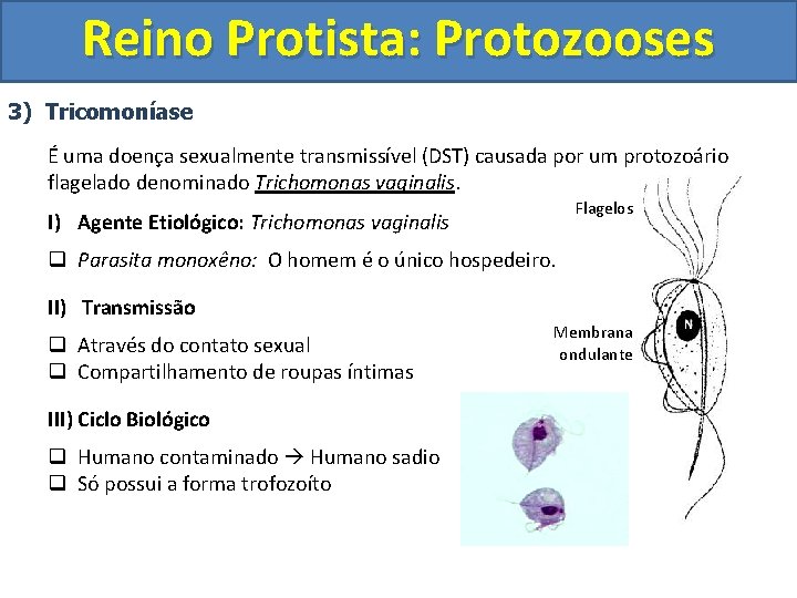 Reino Protista: Protozooses 3) Tricomoníase É uma doença sexualmente transmissível (DST) causada por um