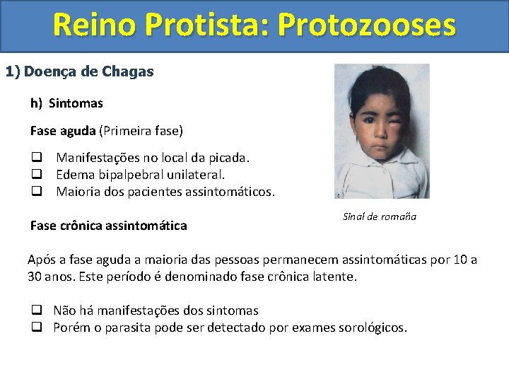 Reino Protista: Protozooses 1) Doença de Chagas h) Sintomas Fase aguda (Primeira fase) q