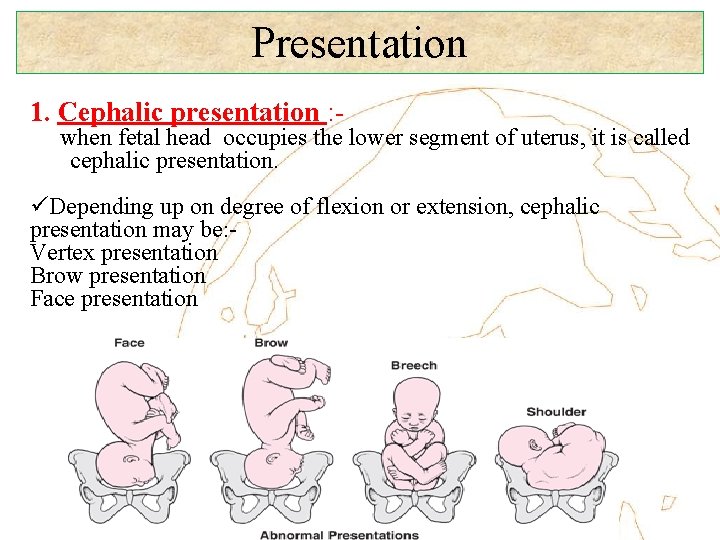 Presentation 1. Cephalic presentation : - when fetal head occupies the lower segment of