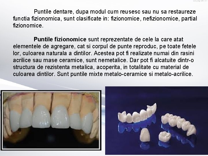 Puntile dentare, dupa modul cum reusesc sau nu sa restaureze functia fizionomica, sunt clasificate Puntile dentare, dupa modul cum reusesc sau nu sa restaureze functia fizionomica, sunt clasificate