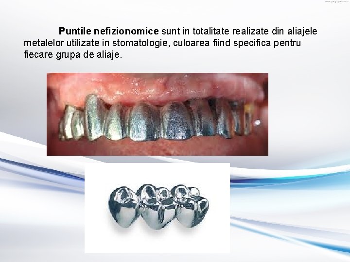 Puntile nefizionomice sunt in totalitate realizate din aliajele metalelor utilizate in stomatologie, culoarea fiind