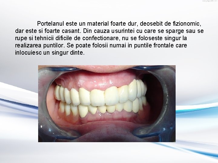 Portelanul este un material foarte dur, deosebit de fizionomic, dar este si foarte casant.