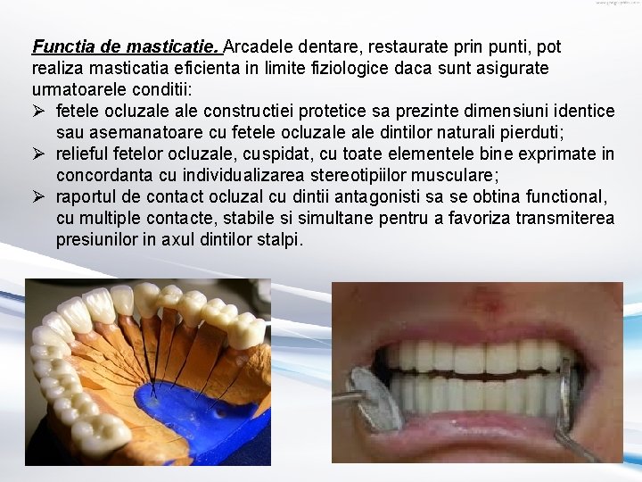Functia de masticatie. Arcadele dentare, restaurate prin punti, pot realiza masticatia eficienta in limite Functia de masticatie. Arcadele dentare, restaurate prin punti, pot realiza masticatia eficienta in limite