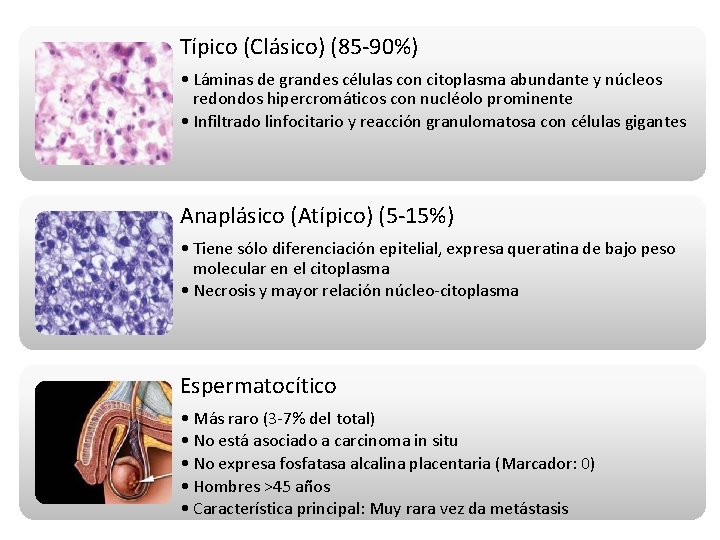 Típico (Clásico) (85 -90%) • Láminas de grandes células con citoplasma abundante y núcleos