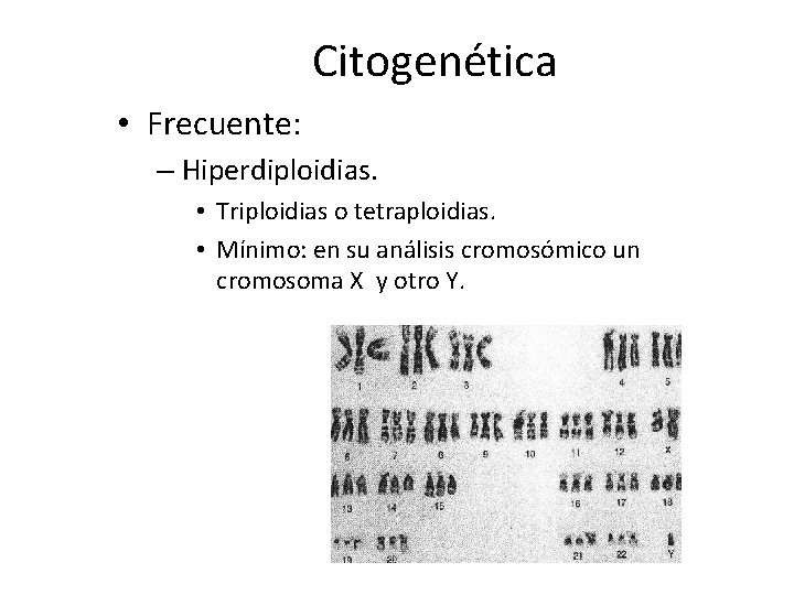 Citogenética • Frecuente: – Hiperdiploidias. • Triploidias o tetraploidias. • Mínimo: en su análisis