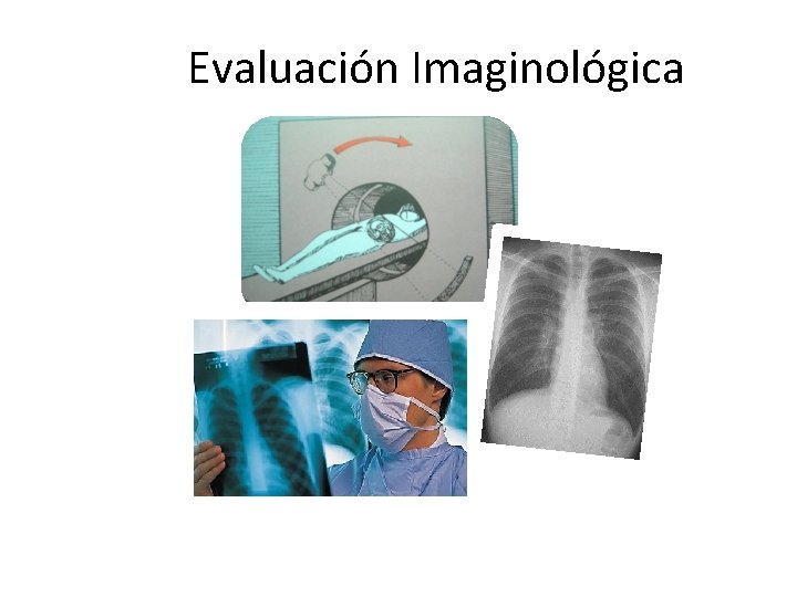 Evaluación Imaginológica 