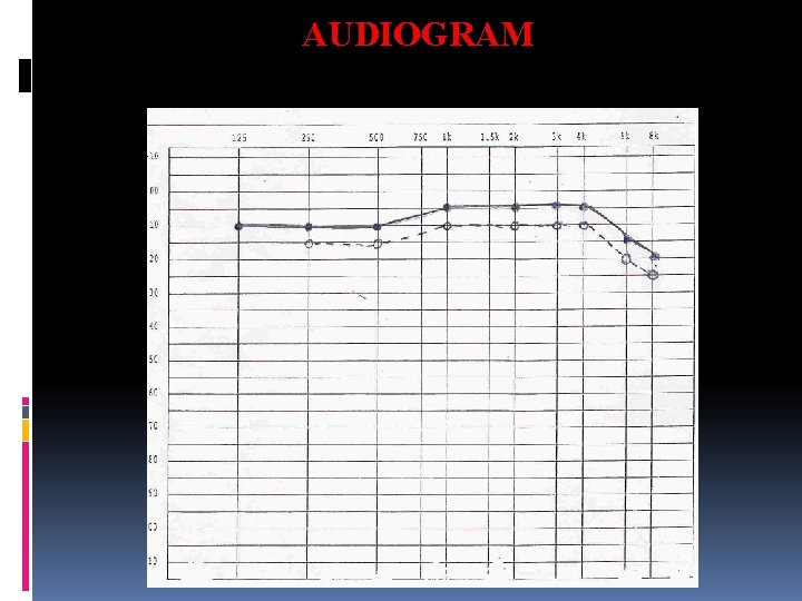 AUDIOGRAM 