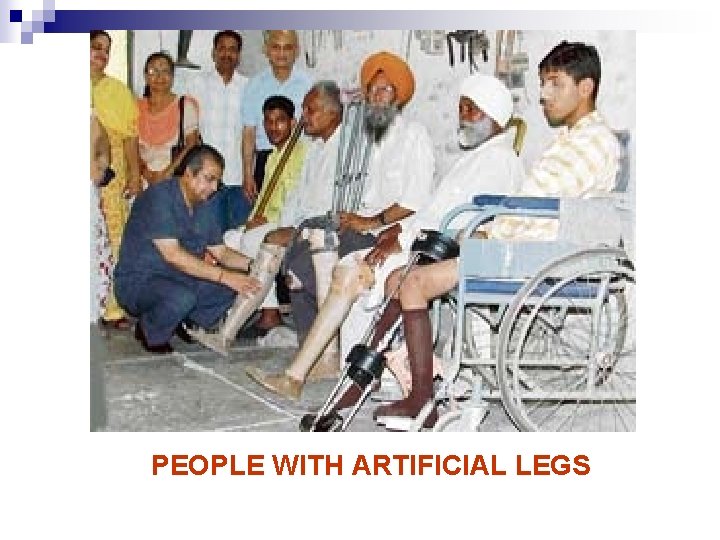 PEOPLE WITH ARTIFICIAL LEGS 