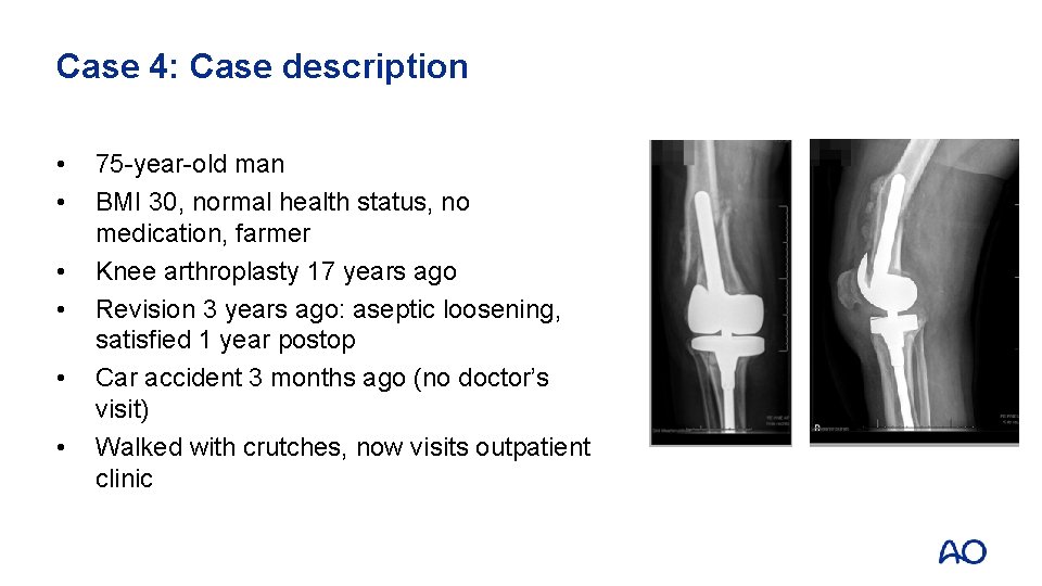 Case 4: Case description • • • 75 -year-old man BMI 30, normal health