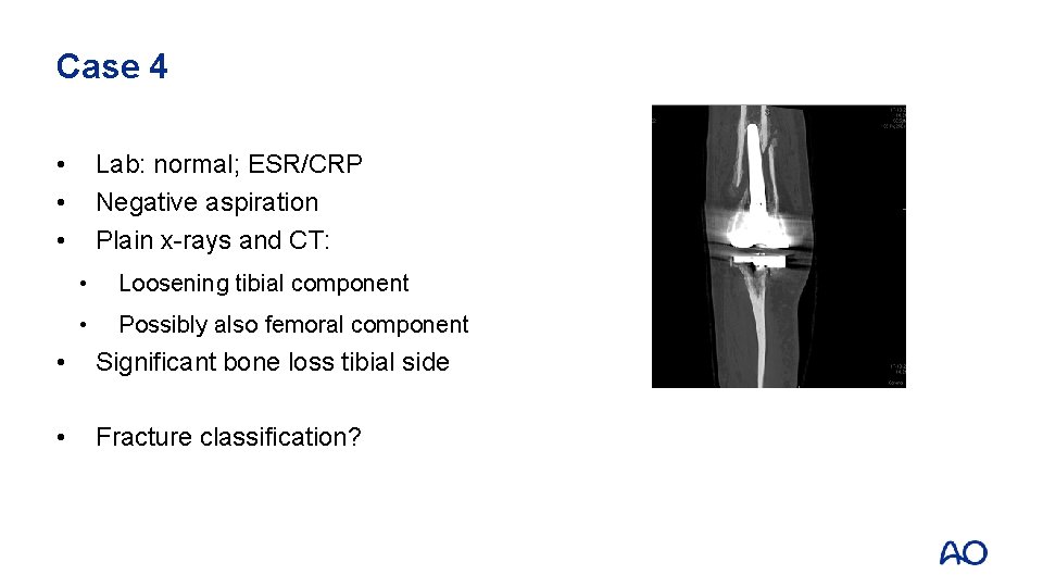 Case 4 • • • Lab: normal; ESR/CRP Negative aspiration Plain x-rays and CT: