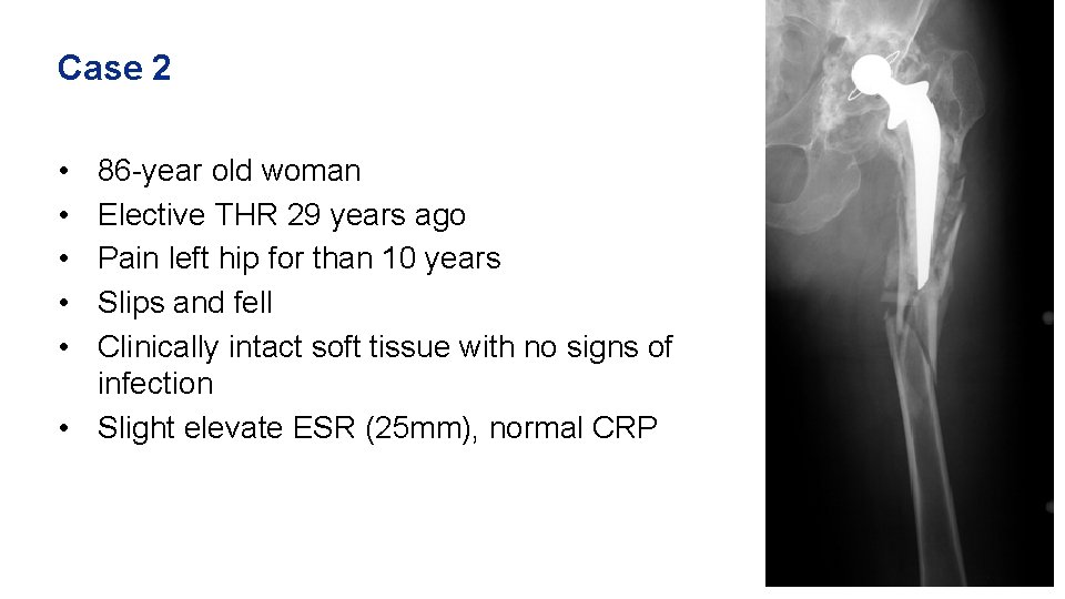 Case 2 • • • 86 -year old woman Elective THR 29 years ago