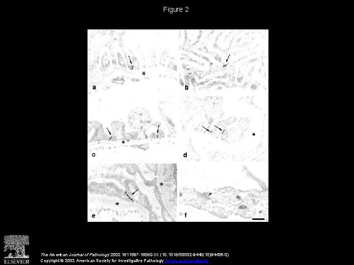 Figure 2 The American Journal of Pathology 2002 1611597 -1606 DOI: (10. 1016/S 0002