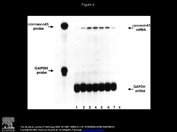 Figure 4 The American Journal of Pathology 2002 1611597 -1606 DOI: (10. 1016/S 0002