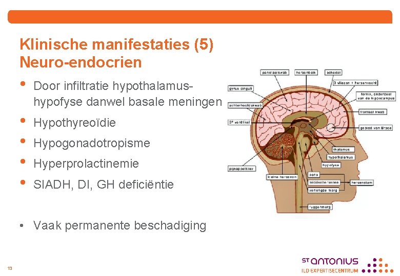 Klinische manifestaties (5) Neuro-endocrien • Door infiltratie hypothalamushypofyse danwel basale meningen • • Hypothyreoïdie