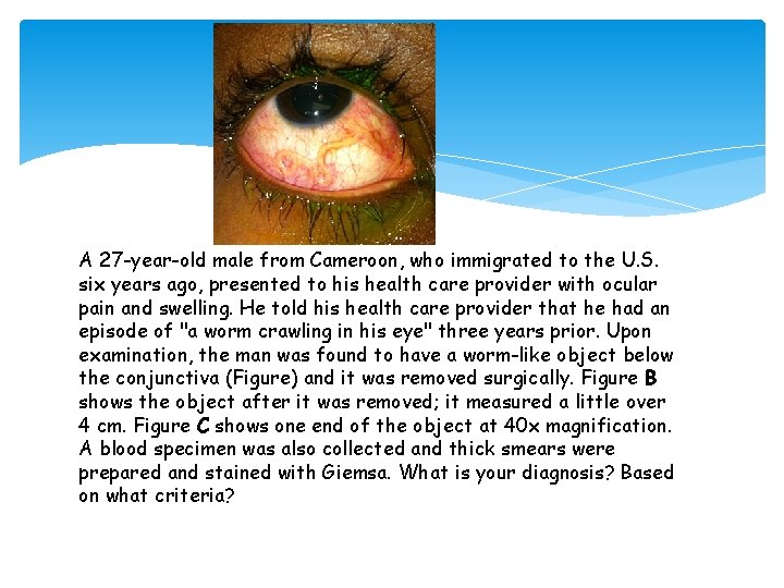 A 27 -year-old male from Cameroon, who immigrated to the U. S. six years A 27 -year-old male from Cameroon, who immigrated to the U. S. six years