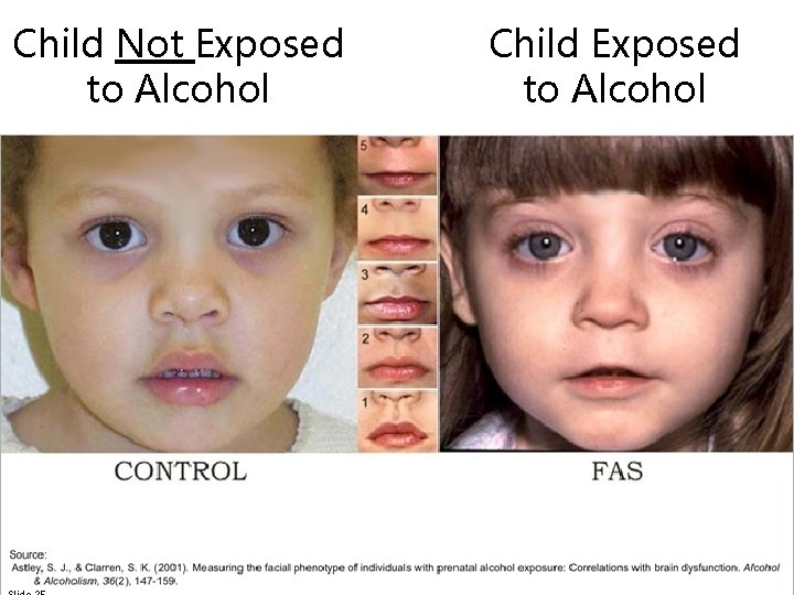 Child Not Exposed to Alcohol Child Exposed to Alcohol 