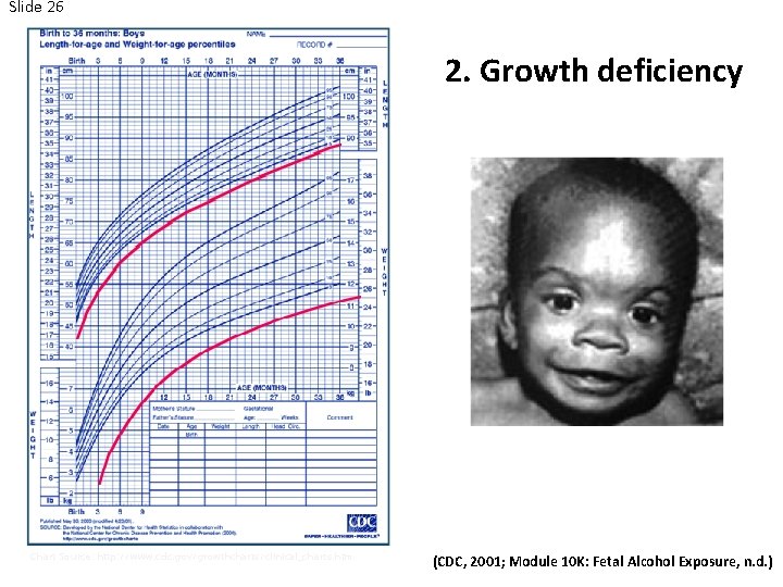 Slide 26 2. Growth Problems 2. Growth deficiency Photo Source: http: //pubs. niaaa. nih.