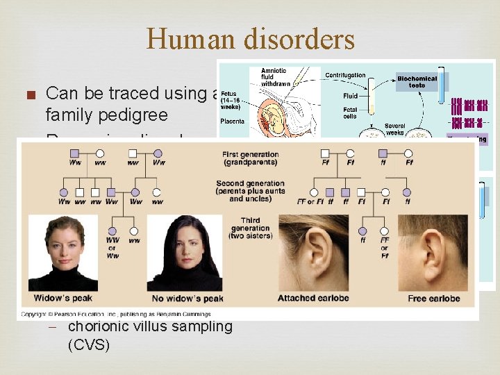 Human disorders ■ Can be traced using a family pedigree ■ Recessive disorders: -