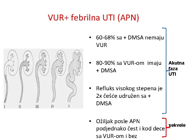 VUR+ febrilna UTI (APN) • 60 -68% sa + DMSA nemaju VUR • 80