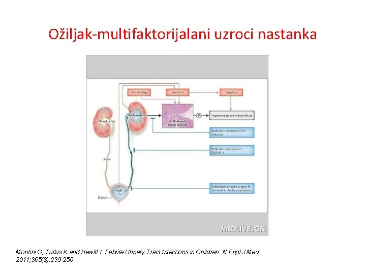 Ožiljak-multifaktorijalani uzroci nastanka Montini G, Tullus K and Hewitt I. Febrile Urinary Tract Infections