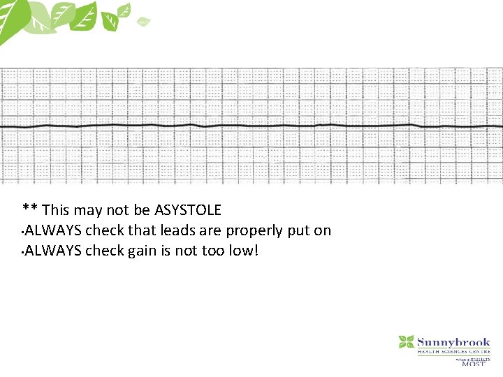 ** This may not be ASYSTOLE • ALWAYS check that leads are properly put