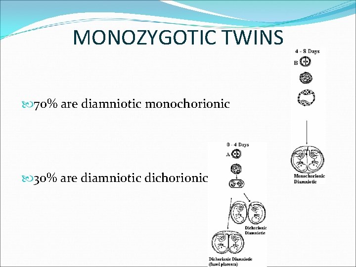 MONOZYGOTIC TWINS 70% are diamniotic monochorionic 30% are diamniotic dichorionic 