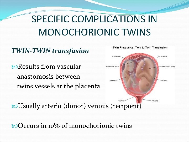 SPECIFIC COMPLICATIONS IN MONOCHORIONIC TWINS TWIN-TWIN transfusion Results from vascular anastomosis between twins vessels