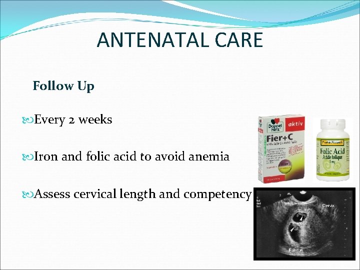 ANTENATAL CARE Follow Up Every 2 weeks Iron and folic acid to avoid anemia