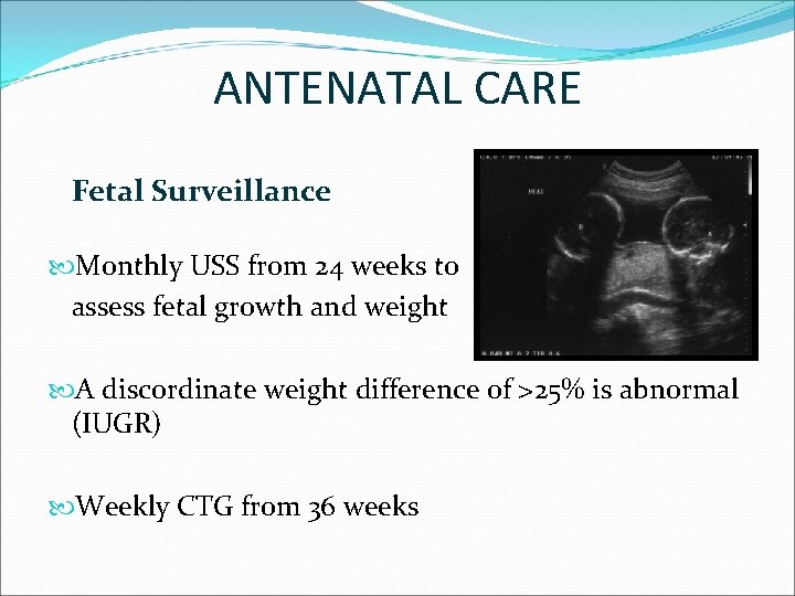 ANTENATAL CARE Fetal Surveillance Monthly USS from 24 weeks to assess fetal growth and