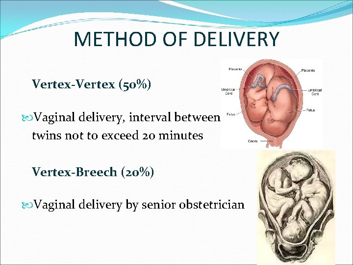 METHOD OF DELIVERY Vertex-Vertex (50%) Vaginal delivery, interval between twins not to exceed 20