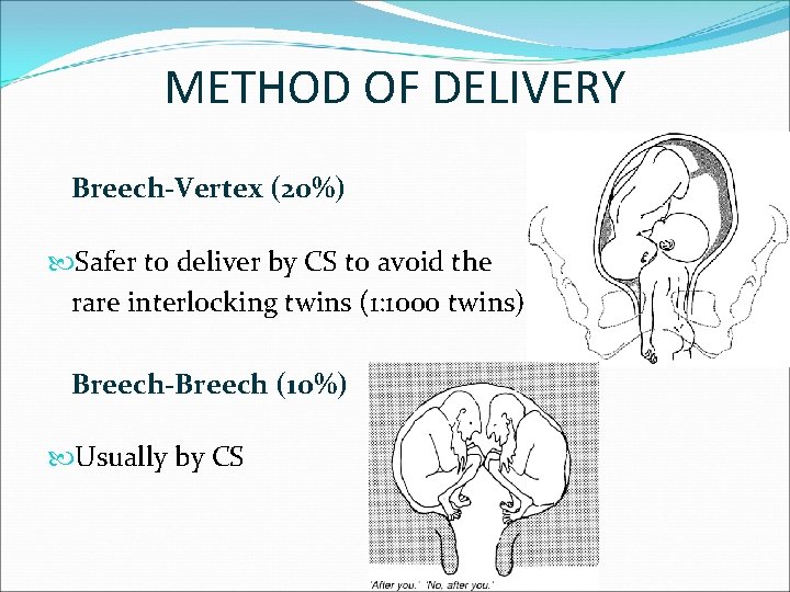METHOD OF DELIVERY Breech-Vertex (20%) Safer to deliver by CS to avoid the rare