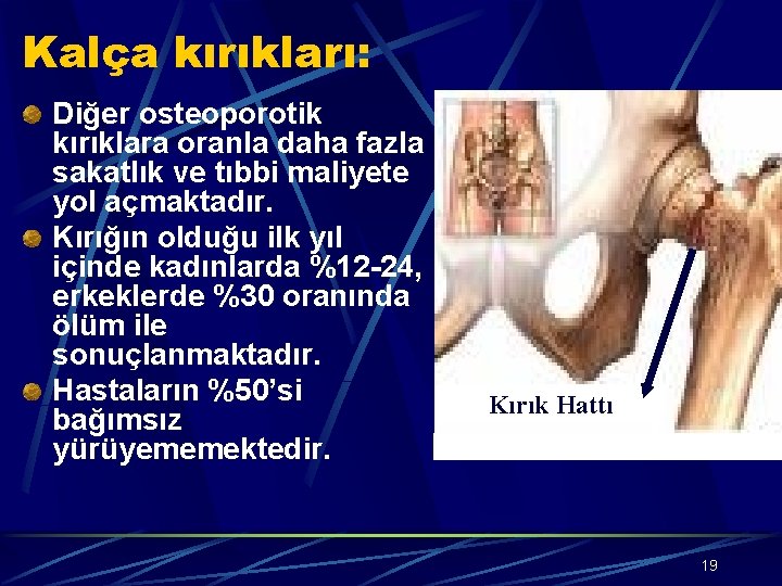 Kalça kırıkları: Diğer osteoporotik kırıklara oranla daha fazla sakatlık ve tıbbi maliyete yol açmaktadır.