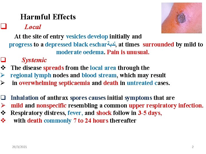 Harmful Effects q Local At the site of entry vesicles develop initially and progress