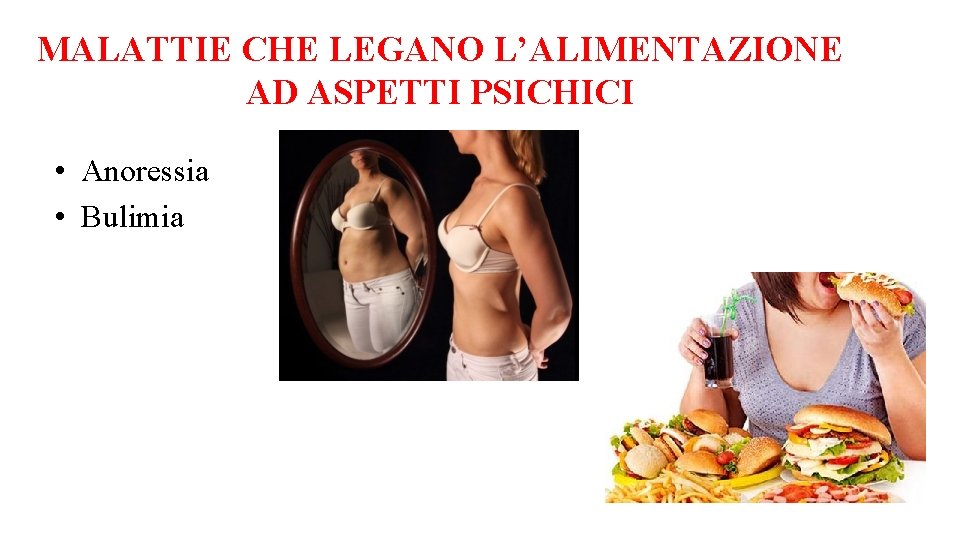 MALATTIE CHE LEGANO L’ALIMENTAZIONE AD ASPETTI PSICHICI • Anoressia • Bulimia 